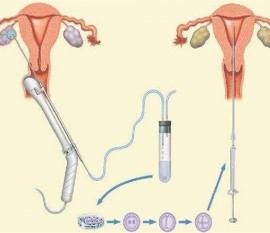 35岁女性备孕请做好以下检查，“健康杭州代生宝宝”跑不远